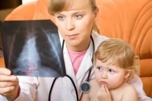 Атипичная пневмония у детей: симптомы и 4 отличия в клинических проявлениях
