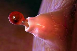 Чем может быть вызвана боль в яичниках перед месячными