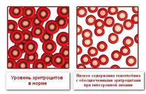 Цветовой показатель крови: причины повышенияи и 5 причин понижения уровня у детей, расшифровка результата