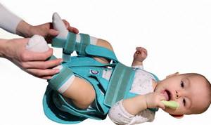 Дисплазия тазобедренных суставов у детей: лечение у новорожденных, грудничков, детей до года