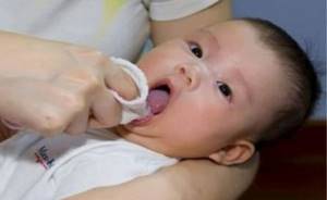 Использование Буры в Глицерине при лечении молочницы