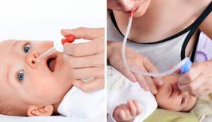 Как промывать нос ребенку: 6 показаний для процедуры, 4 правила промывания