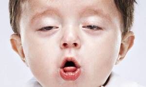 Лающий кашель у ребенка с насморком и без: 2 главные причины, симптомы, как лечить, профилактика