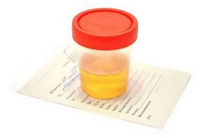 Оксалаты в моче у ребенка: 8 причин появления, методы лечения
