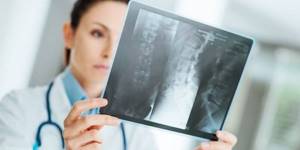 Остеопетроз: 3 обязательных этапа диагностики и 3 метода борьбы с заболеванием