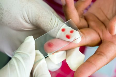 Повышенные моноциты в крови у ребенка: 6 причин повышения, подготовка к анализу, расшифровка результатов
