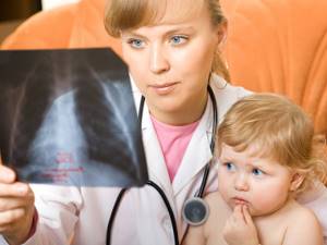 Признаки пневмонии у детей при каждой из 9 возможных форм