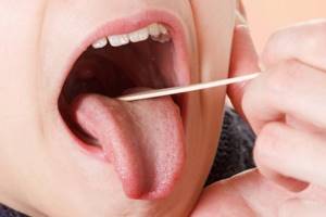 Стрептококк в горле у детей: симптомы, 6 методов лечения, 4 осложнения