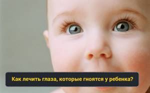 У ребенка гноятся глаза: 3 вероятных причины-заболевания, методы лечения и профилактика