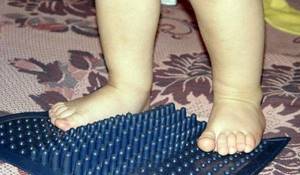Виды плоскостопия у детей: 4 разновидности и рекомендации от педиатра