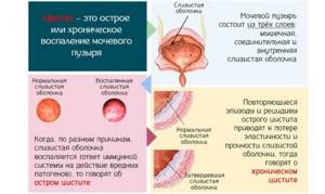 Как снять холтер в домашних условиях фото пошагово видео