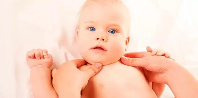 Кривошея у новорожденных: 4 признака и 4 главных причины, лечение, 2 упражнения при кривошее