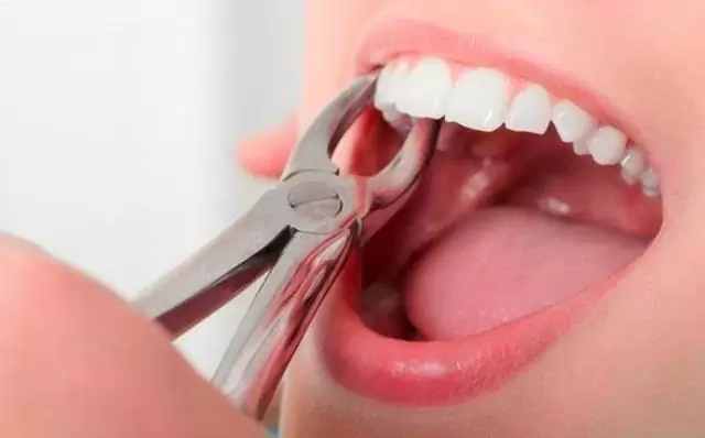 Лечение зубов во время менструации: за и против
