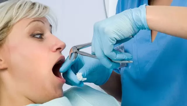 Лечение зубов во время менструации: за и против
