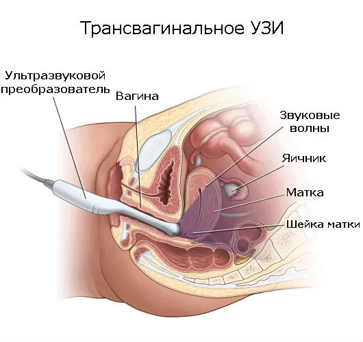 На какой день менструального цикла проводится УЗИ органов малого таза