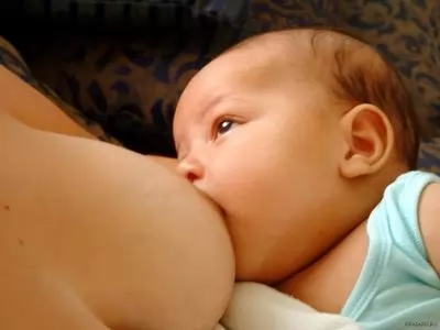 Желтушка у новорожденных: виды, причины, последствия, лечение, профилактика, видео